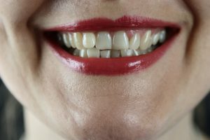dentists north wales